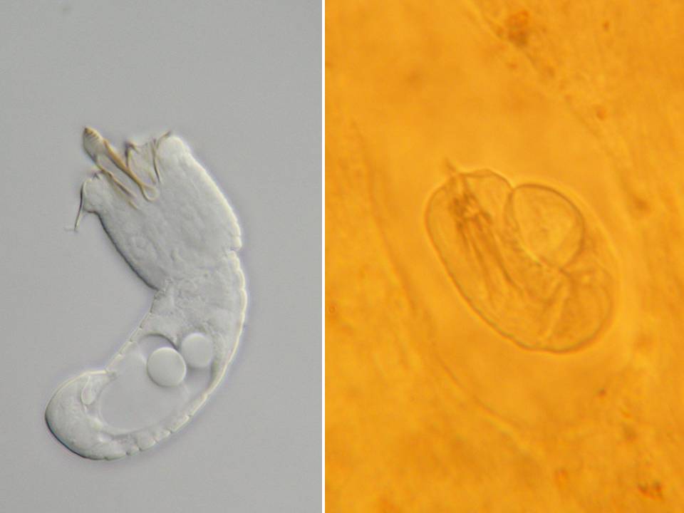 Paragordius Kenay Larvae and Cysts